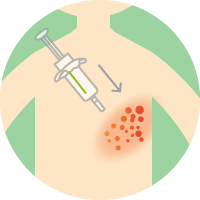 帯状疱疹ワクチン